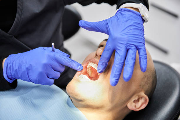 Best Emergency Dentist for Lost Fillings or Crowns in La Grange, TX